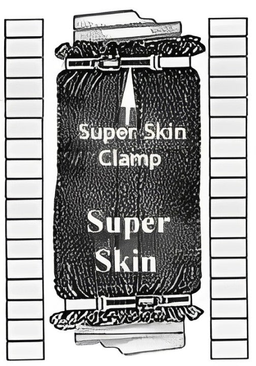 Super Skin™Clamp Blanket Protector